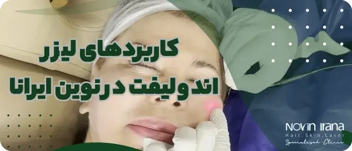 کاربردهای لیزر اندولیفت در نوین ایرانا